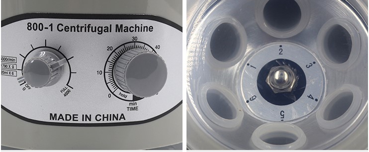 Centrífuga médica eléctrica de - Xlab Medical reseña y precio