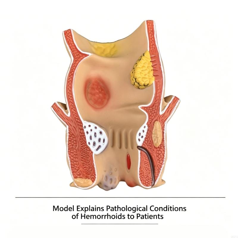 Modelo enseñanza patología 3D  - Medical Lab Observer reseña y precio