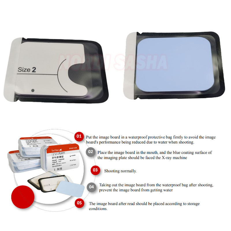 Placa de imagen de fósforo Den - Medical X reseña y precio